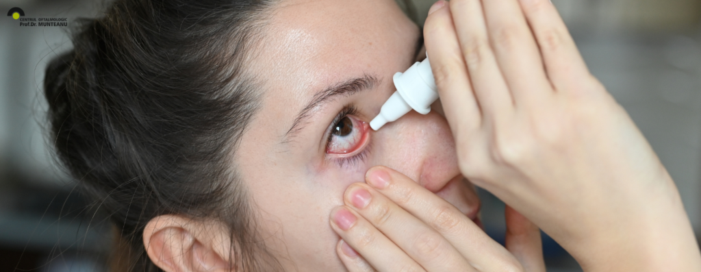 ochiul uscat este o afectiune comuna caracterizata de insuficienta lacrimilor si de disconfort ocular, oftalmologie
